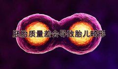 �Թ�Ӥ������̥������ᵼ��̥��������